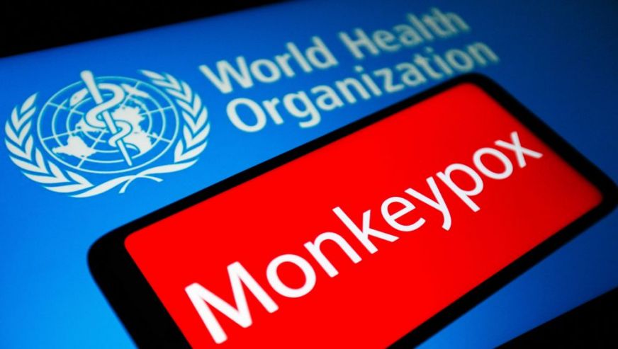 Dünya Sağlık Örgütü, maymun çiçeği salgınını 