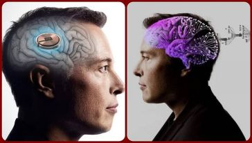 Elon Musk'ın Neuralink çipi 'Telepati', ilk kez bir insanın beynine yerleştirildi...
