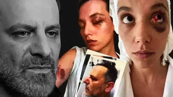 Ünlü oyuncu Ozan Güven'e 'hapis cezası' şoku..!
