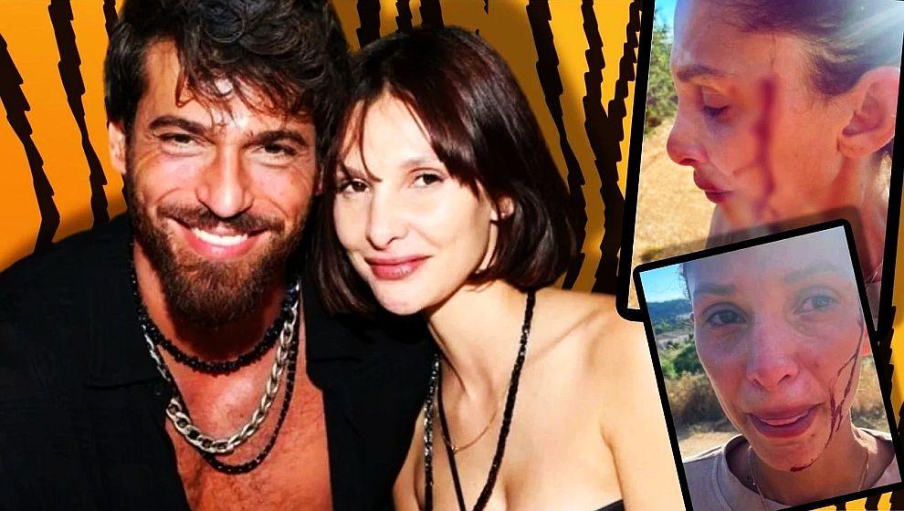 Ünlü oyuncu Can Yaman'ın sevgilisi kanlar içinde paylaşım yaptı: 