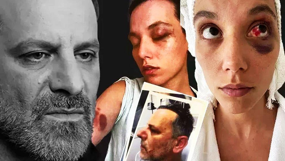 45 gün hapis yatacak! Deniz Bulutsuz'u darp eden Ozan Güven'in cezası onandı...