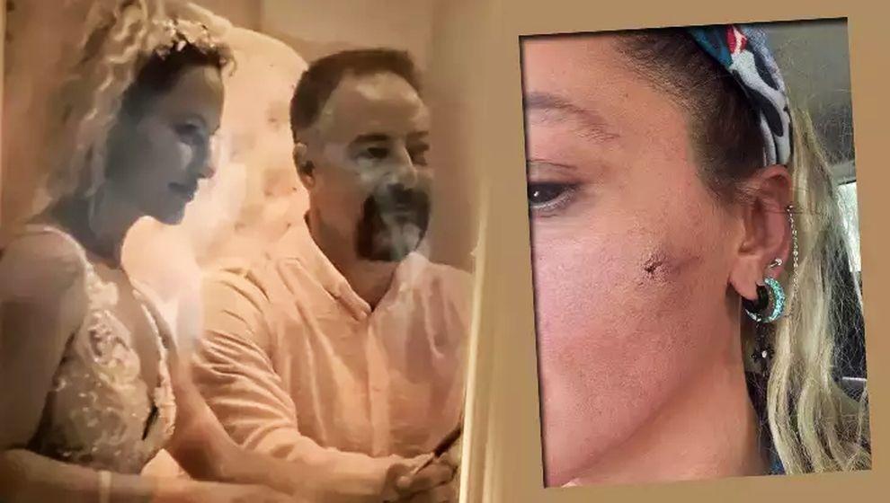 Yıldız Asyalı eşinden şiddet gördüğünü açıklamıştı! Eşinden yanıt geldi: ''Kendisi şiddete meyilli bir insan