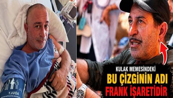 Cem Yılmaz'ın rahatsızlığı sonrası gündeme gelmişti... Kulak memesindeki 'Frank işareti' ne anlama geliyor?